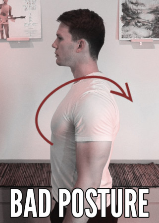 poor-posture-diagram - Back in Action